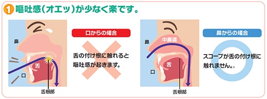 内視鏡検査1